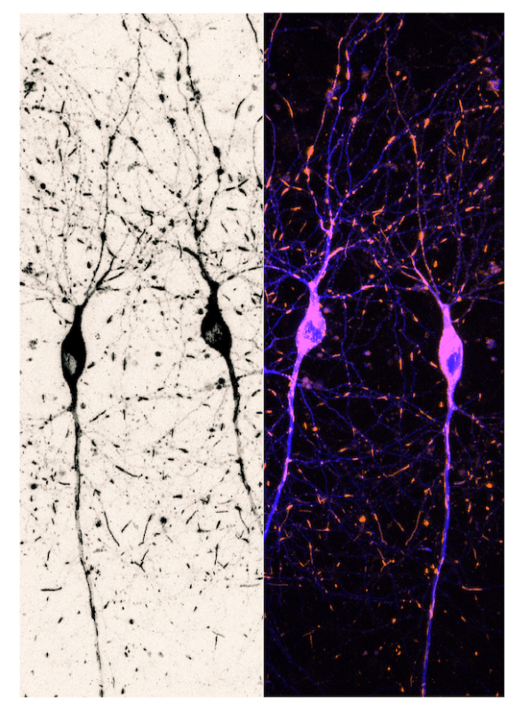 Evolution of Cajal’s drawings © S. Rodriguez-Rozada, Center for Molecular Neurobiology Hamburg (DE)