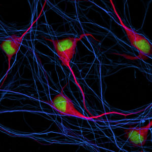 Brain Conference April 2022
